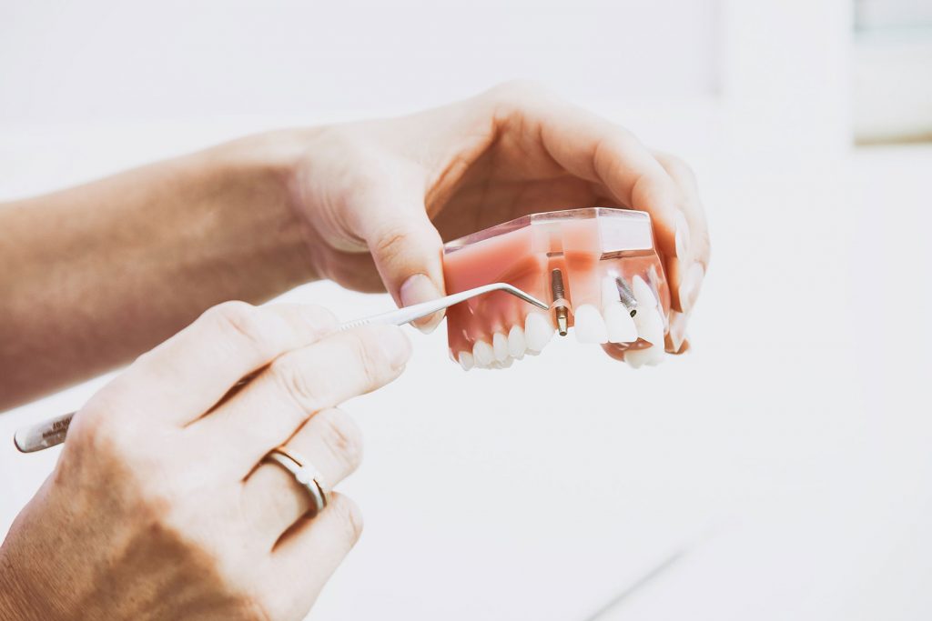 Formation prothèse dentaire – Comment devenir prothésiste dentaire ?
